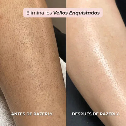 Rasuradora 2 en 1 para Bikini y Cuerpo