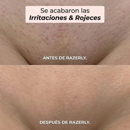 Rasuradora 2 en 1 para Bikini y Cuerpo